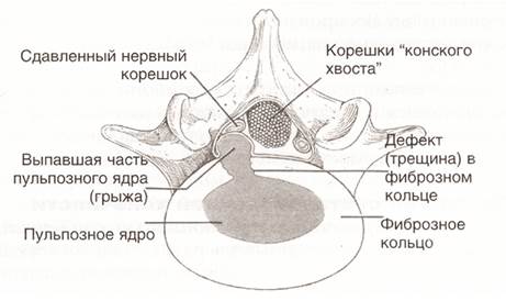 vertebra1